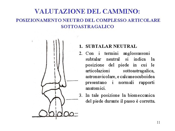 VALUTAZIONE DEL CAMMINO: POSIZIONAMENTO NEUTRO DEL COMPLESSO ARTICOLARE SOTTOASTRAGALICO 1. SUBTALAR NEUTRAL 2. Con