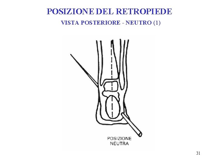 POSIZIONE DEL RETROPIEDE VISTA POSTERIORE - NEUTRO (1) 31 