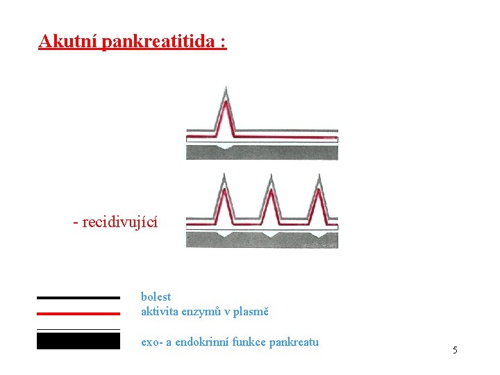 Akutní pankreatitida : - recidivující bolest aktivita enzymů v plasmě exo- a endokrinní funkce