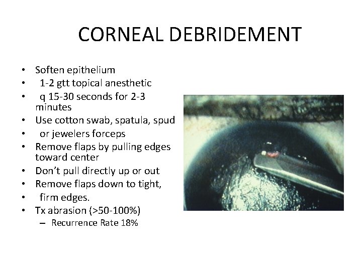 CORNEAL DEBRIDEMENT • Soften epithelium • 1 -2 gtt topical anesthetic • q 15