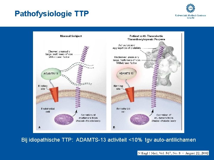 Pathofysiologie TTP Bij idiopathische TTP: ADAMTS-13 activiteit <10% tgv auto-antilichamen 