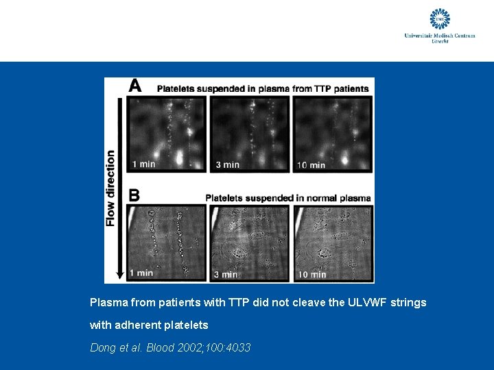 Plasma from patients with TTP did not cleave the ULVWF strings with adherent platelets