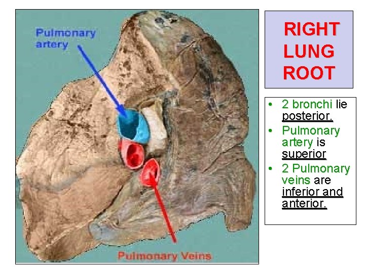 RIGHT LUNG ROOT • 2 bronchi lie posterior. • Pulmonary artery is superior •