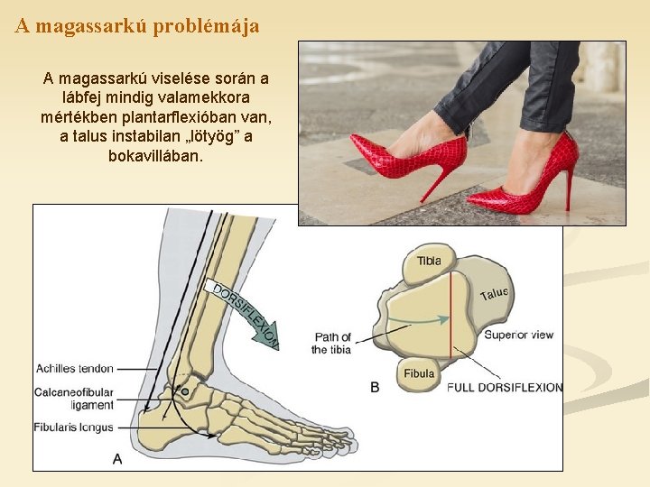 A magassarkú problémája A magassarkú viselése során a lábfej mindig valamekkora mértékben plantarflexióban van,