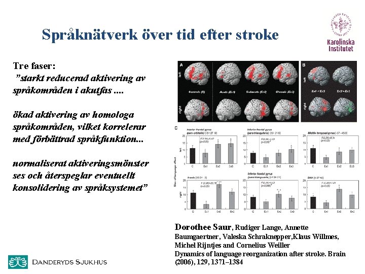 Språknätverk över tid efter stroke Tre faser: ”starkt reducerad aktivering av språkområden i akutfas.