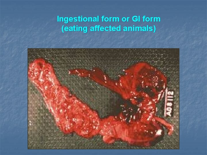 Ingestional form or GI form (eating affected animals) 