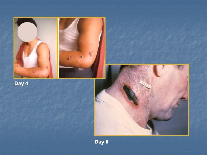 Day 4 Day 6 