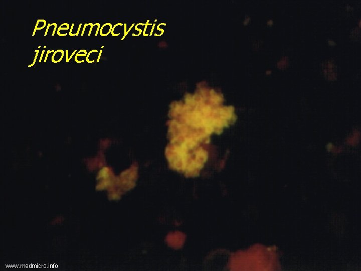 Pneumocystis jiroveci www. medmicro. info 