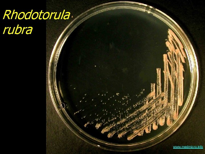 Rhodotorula rubra www. medmicro. info 