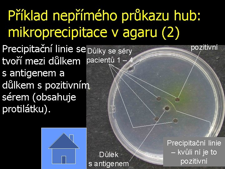 Příklad nepřímého průkazu hub: mikroprecipitace v agaru (2) Precipitační linie se Důlky se séry