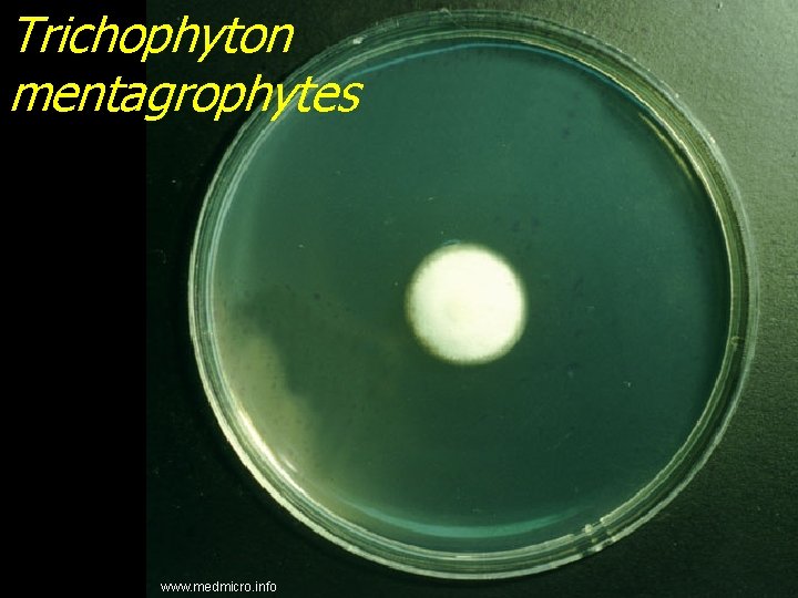 Trichophyton mentagrophytes www. medmicro. info 