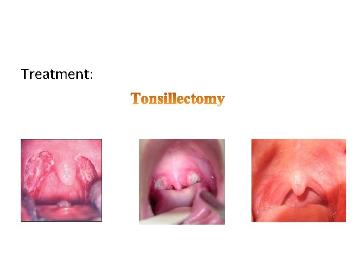 Treatment: 