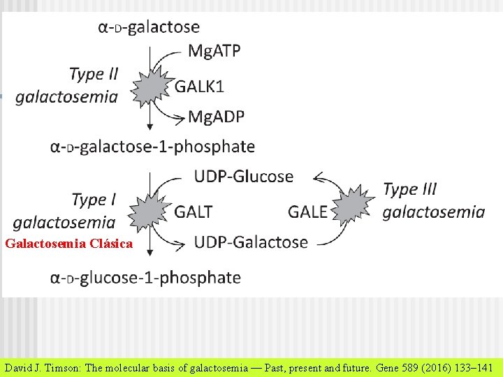 Galactosemia Clásica David J. Timson: The molecular basis of galactosemia — Past, present and