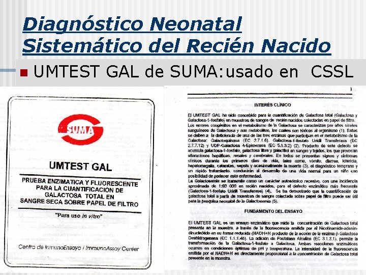 Diagnóstico Neonatal Sistemático del Recién Nacido n UMTEST GAL de SUMA: usado en CSSL