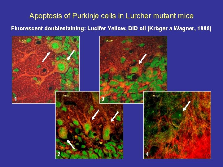 Apoptosis of Purkinje cells in Lurcher mutant mice Fluorescent doublestaining: Lucifer Yellow, Di. D
