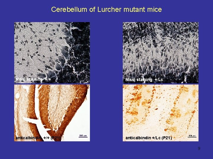 Cerebellum of Lurcher mutant mice Nissl staining +/+ Nissl staining +/Lc anticalbindin +/+ (P