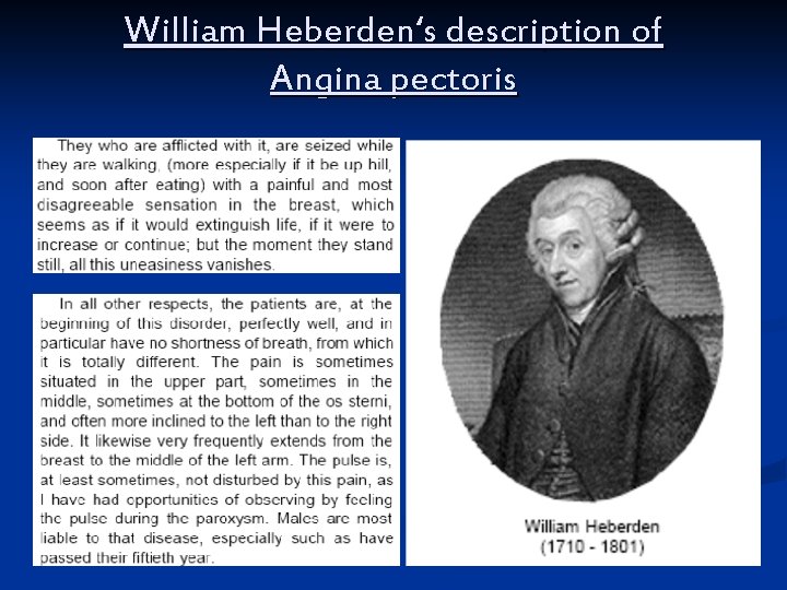 William Heberden‘s description of Angina pectoris 