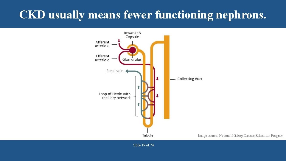 CKD usually means fewer functioning nephrons. Image source: National Kidney Disease Education Program Slide