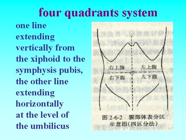 four quadrants system one line extending vertically from the xiphoid to the symphysis pubis,