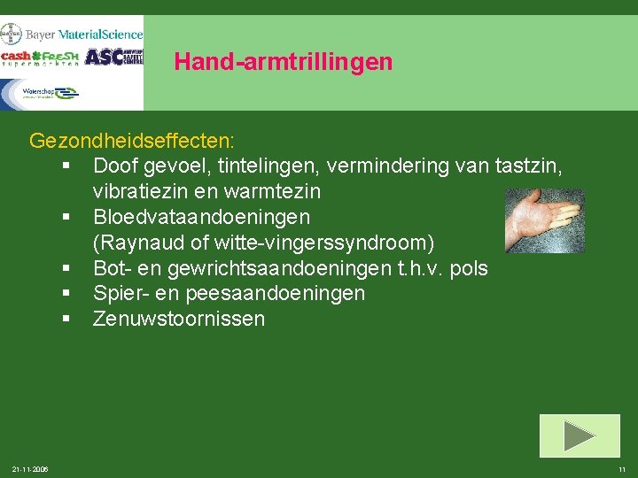 Hand-armtrillingen Gezondheidseffecten: § Doof gevoel, tintelingen, vermindering van tastzin, vibratiezin en warmtezin § Bloedvataandoeningen