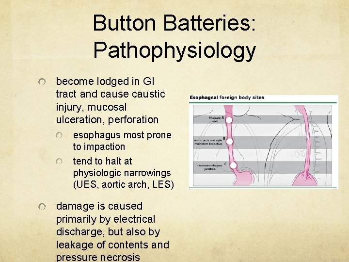 Button Batteries: Pathophysiology become lodged in GI tract and cause caustic injury, mucosal ulceration,