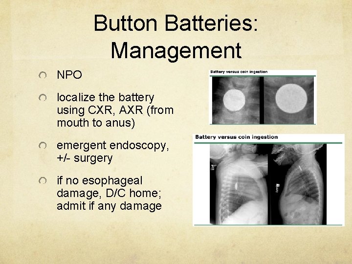 Button Batteries: Management NPO localize the battery using CXR, AXR (from mouth to anus)
