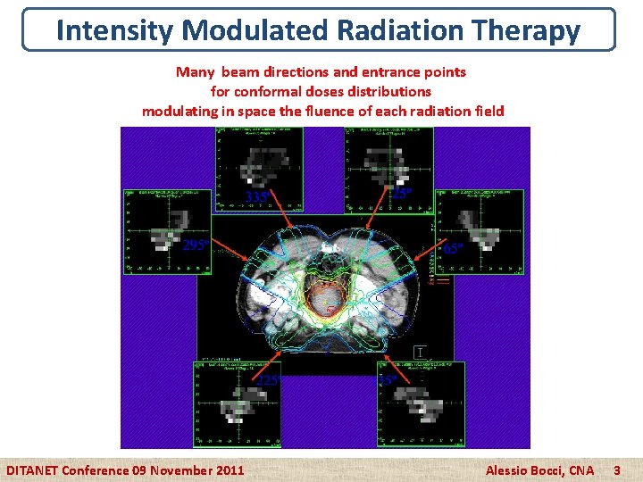 Intensity Modulated Radiation Therapy Many beam directions and entrance points for conformal doses distributions