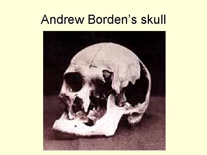 Andrew Borden’s skull 