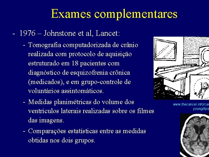 Exames complementares - 1976 – Johnstone et al, Lancet: - Tomografia computadorizada de crânio