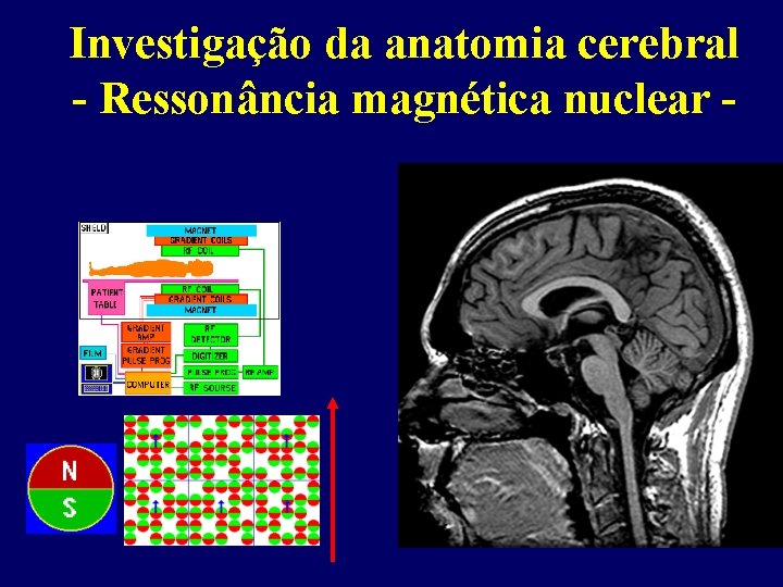 Investigação da anatomia cerebral - Ressonância magnética nuclear - 