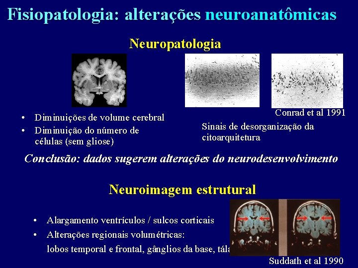 Fisiopatologia: alterações neuroanatômicas Neuropatologia • Diminuições de volume cerebral • Diminuição do número de