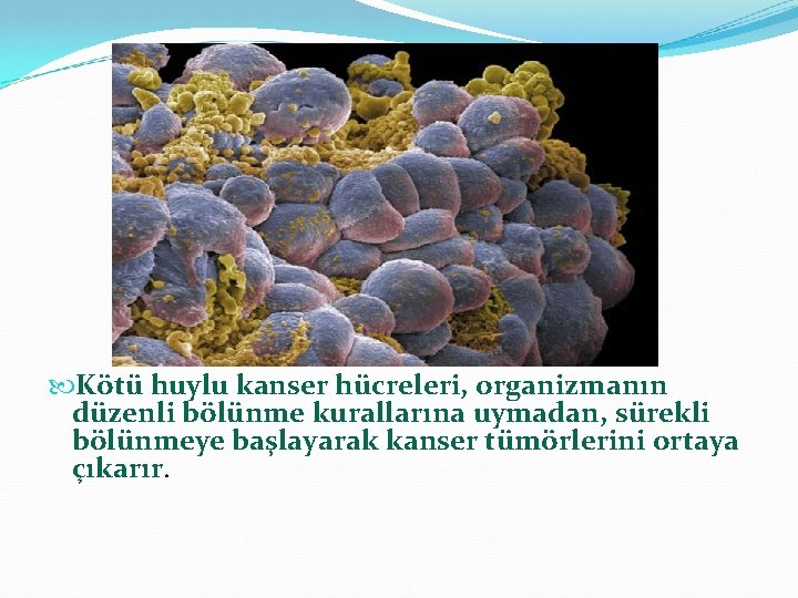  Kötü huylu kanser hücreleri, organizmanın düzenli bölünme kurallarına uymadan, sürekli bölünmeye başlayarak kanser