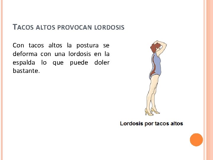 TACOS ALTOS PROVOCAN LORDOSIS Con tacos altos la postura se deforma con una lordosis