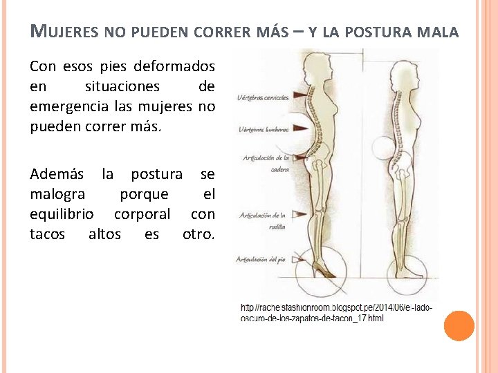 MUJERES NO PUEDEN CORRER MÁS – Y LA POSTURA MALA Con esos pies deformados