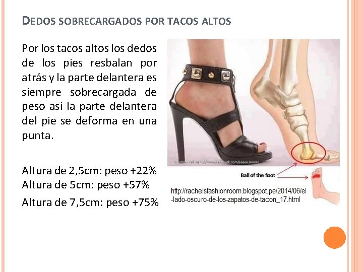 DEDOS SOBRECARGADOS POR TACOS ALTOS Por los tacos altos los dedos de los pies