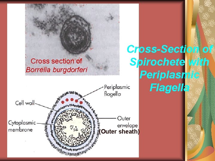 Cross section of Borrelia burgdorferi Cross-Section of Spirochete with Periplasmic Flagella (Outer sheath) 