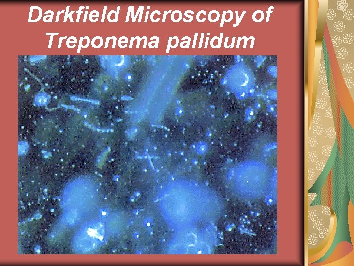 Darkfield Microscopy of Treponema pallidum 