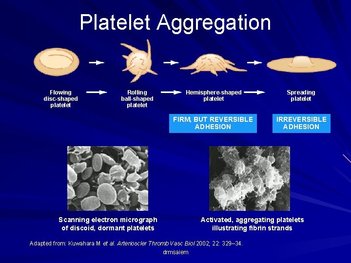 Platelet Aggregation Flowing disc-shaped platelet Rolling ball-shaped platelet Hemisphere-shaped platelet Spreading platelet FIRM, BUT