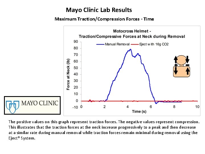 Mayo Clinic Lab Results Maximum Traction/Compression Forces - Time The positive values on this Mayo Clinic Lab Results Maximum Traction/Compression Forces - Time The positive values on this