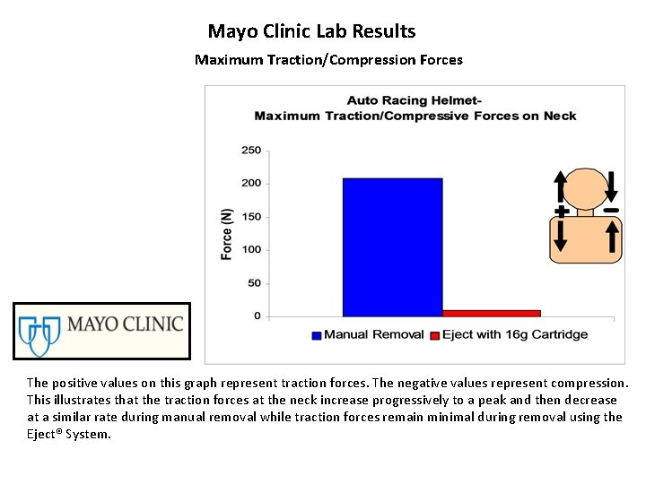 Mayo Clinic Lab Results Maximum Traction/Compression Forces The positive values on this graph represent Mayo Clinic Lab Results Maximum Traction/Compression Forces The positive values on this graph represent