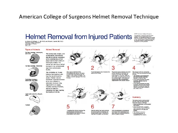 American College of Surgeons Helmet Removal Technique American College of Surgeons Helmet Removal Technique