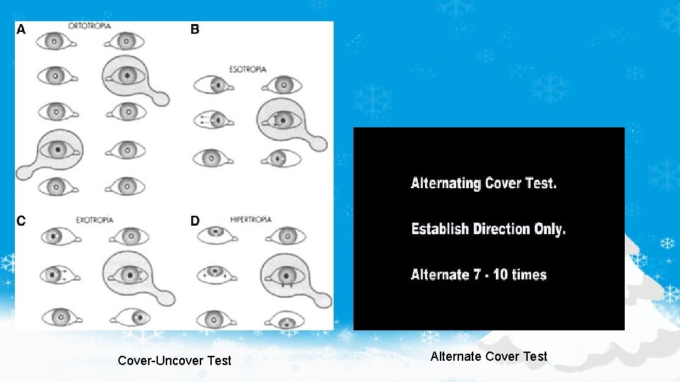 Cover-Uncover Test Alternate Cover Test 