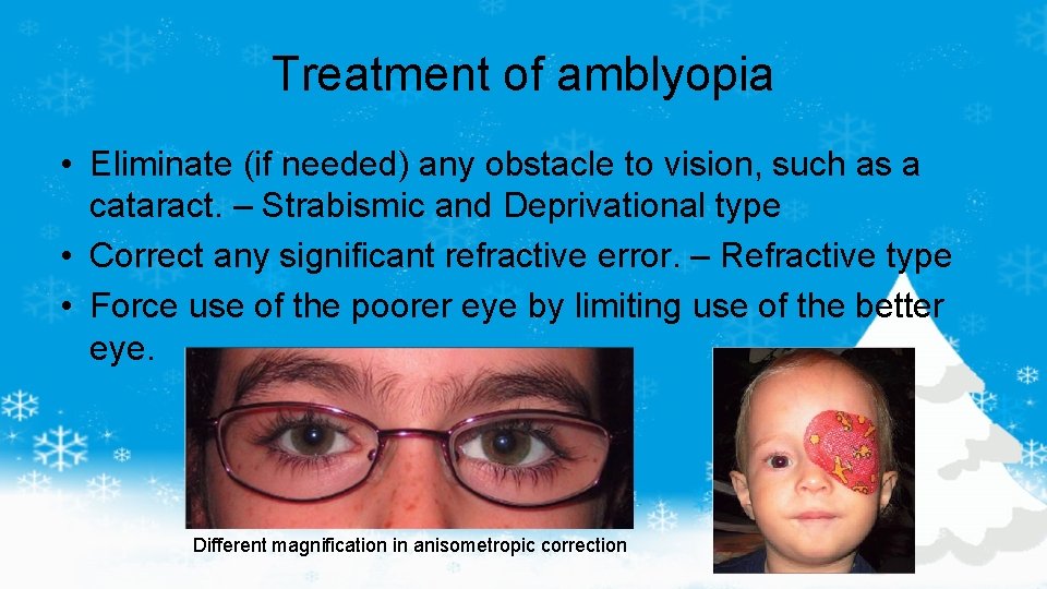 Treatment of amblyopia • Eliminate (if needed) any obstacle to vision, such as a