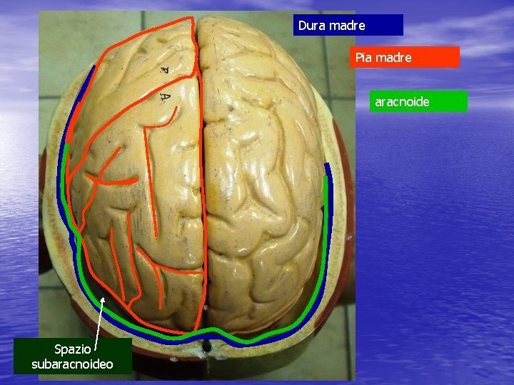 Dura madre Pia madre aracnoide Spazio subaracnoideo 