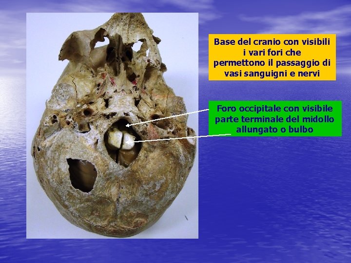 Base del cranio con visibili i vari fori che permettono il passaggio di vasi