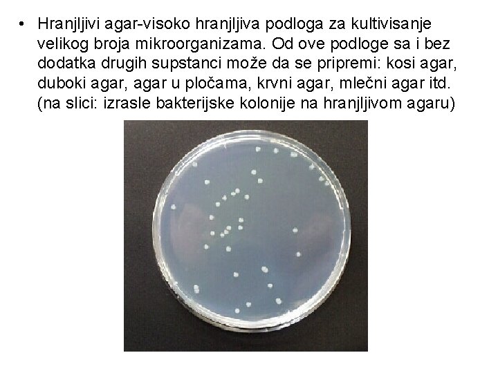 • Hranjljivi agar-visoko hranjljiva podloga za kultivisanje velikog broja mikroorganizama. Od ove podloge • Hranjljivi agar-visoko hranjljiva podloga za kultivisanje velikog broja mikroorganizama. Od ove podloge