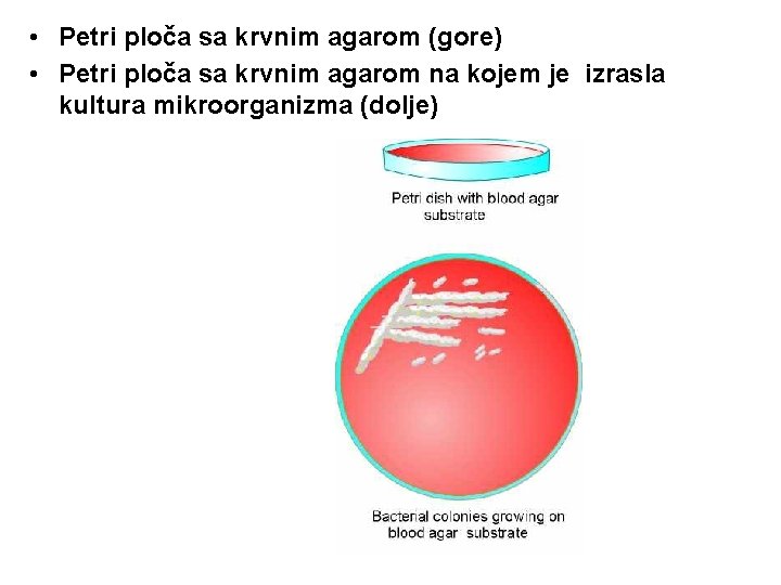 • Petri ploča sa krvnim agarom (gore) • Petri ploča sa krvnim agarom • Petri ploča sa krvnim agarom (gore) • Petri ploča sa krvnim agarom