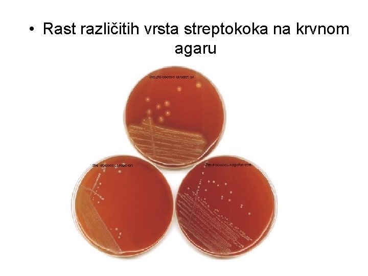 • Rast različitih vrsta streptokoka na krvnom agaru • Rast različitih vrsta streptokoka na krvnom agaru