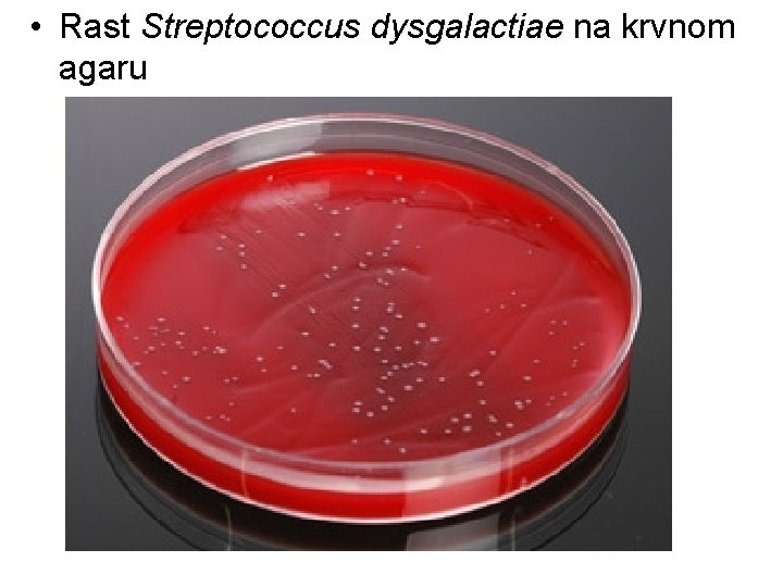 • Rast Streptococcus dysgalactiae na krvnom agaru • Rast Streptococcus dysgalactiae na krvnom agaru