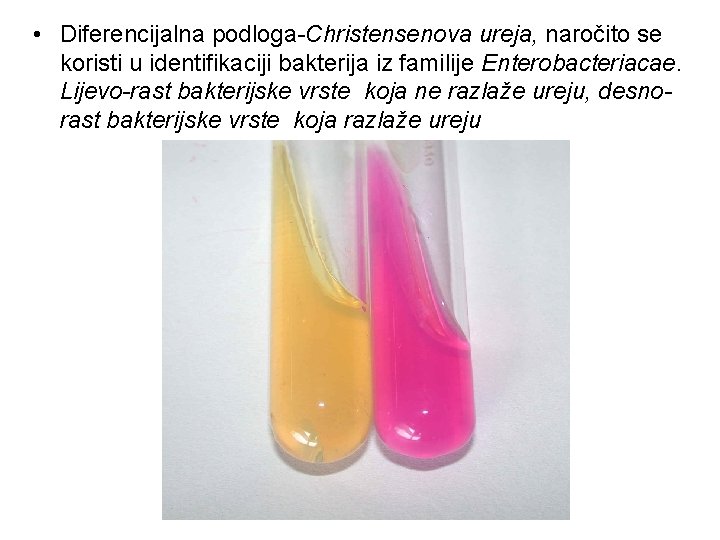 • Diferencijalna podloga-Christensenova ureja, naročito se koristi u identifikaciji bakterija iz familije Enterobacteriacae. • Diferencijalna podloga-Christensenova ureja, naročito se koristi u identifikaciji bakterija iz familije Enterobacteriacae.